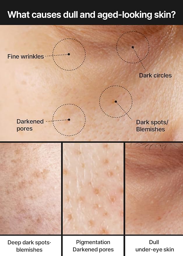 Celimax- Pore + Dark Spot Brightening Cream