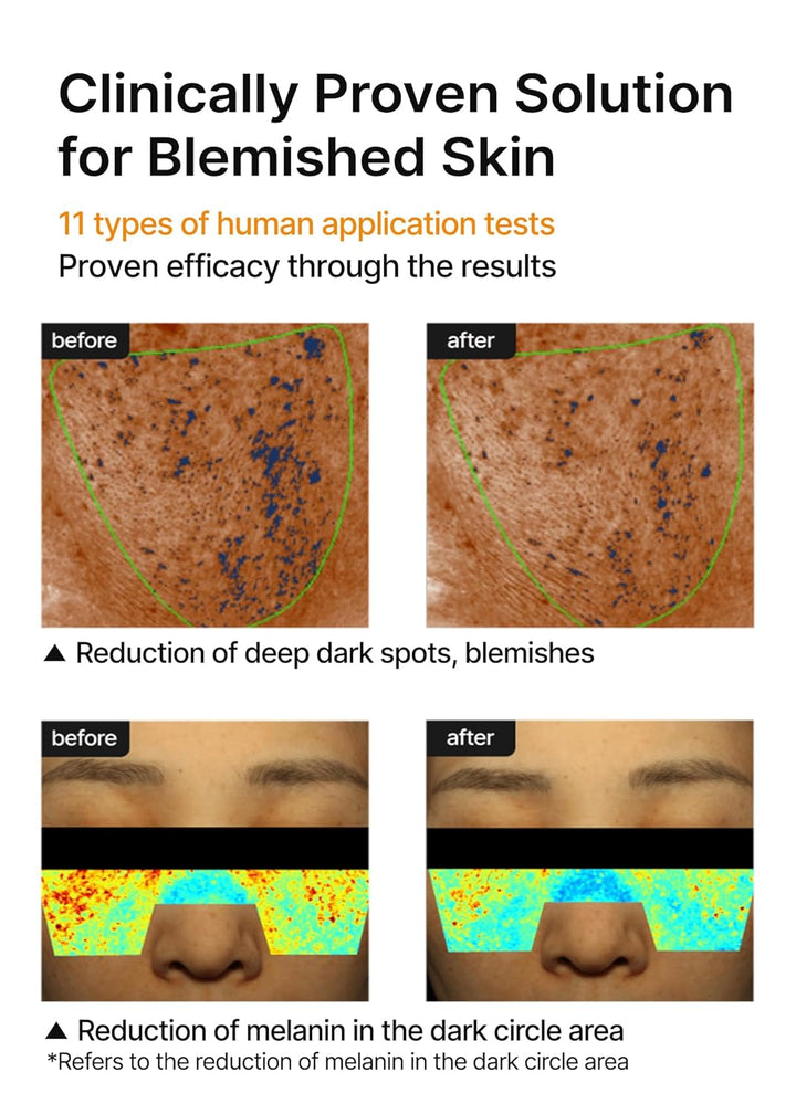 Celimax- Pore + Dark Spot Brightening Cream