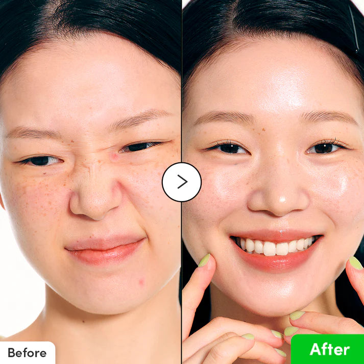 Eqqualberry Aloe PDRN Calming Serum